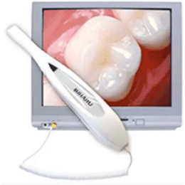 An Intra-Oral Camera